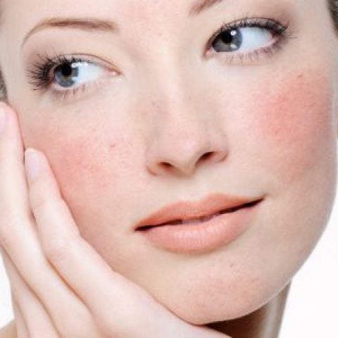 Rosacea Control